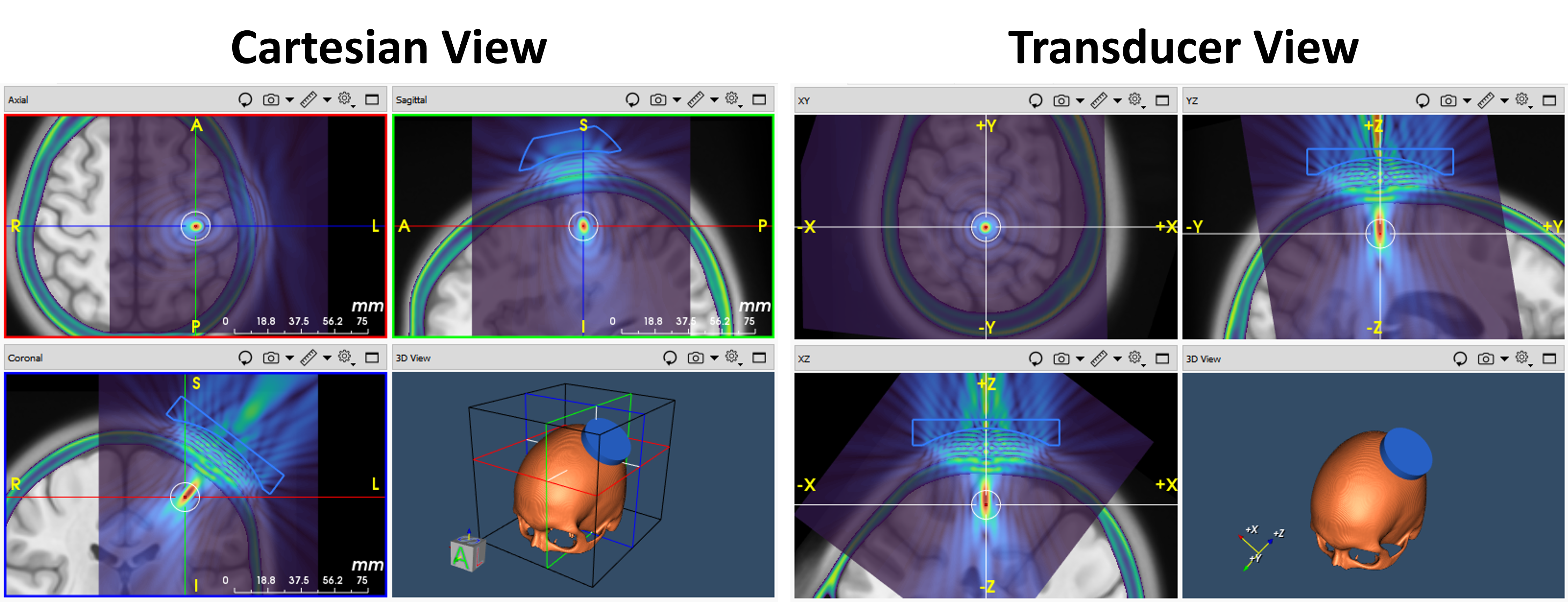 World view to transducer view